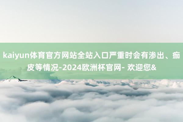 kaiyun体育官方网站全站入口严重时会有渗出、痂皮等情况-